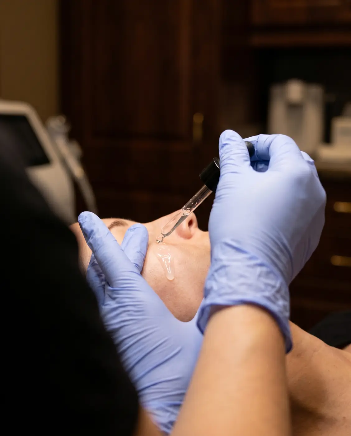 Micro-Needling Complex result